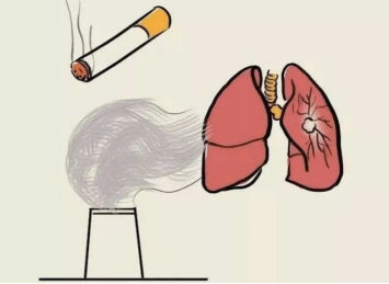 Diagnosis and treatment of pulmonary nodules